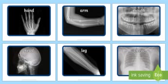 X ray Display Photos