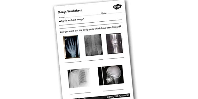 X-ray Worksheet - xray, x-ray, xray worksheet, bones, the human