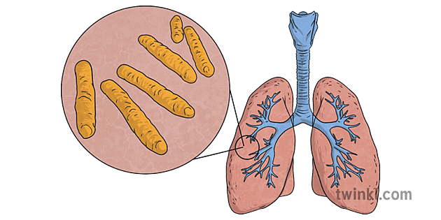 Tuberculosis Bacteria Illustration Twinkl