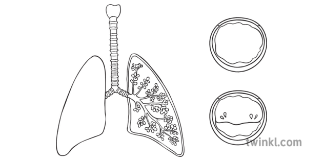Cystic Fibrosis Lungs Mucus Diagram Unlabelled Genetic