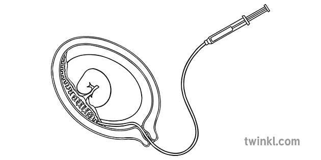 Chorionic Villi Sampling Diagram Sex Genetic Genes Gender Science Secondary Bw 