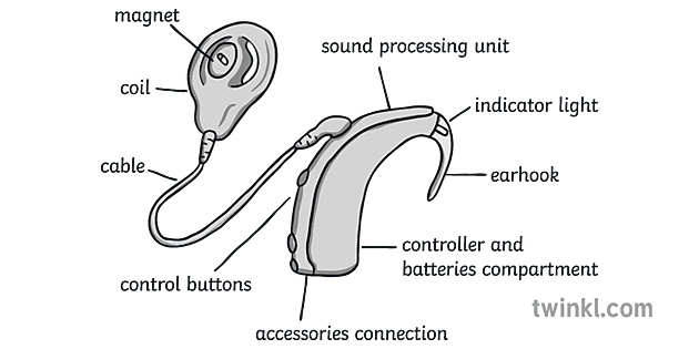 Cochlear Implant Hearing Deaf Labelled Ks1 Illustration - Twinkl