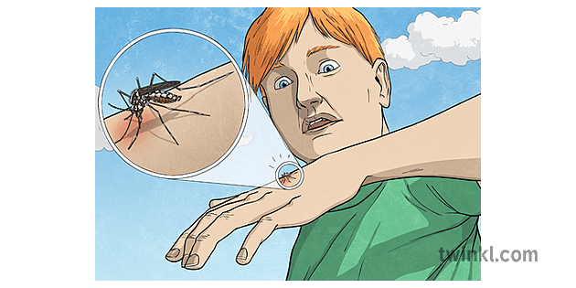 Mosquito Biting Boy Malaria Insect Bite KS2 - Twinkl