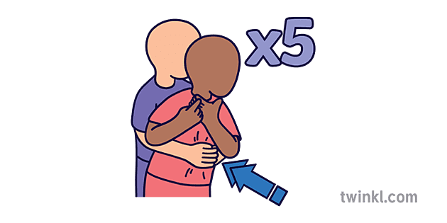 Sym Five Abdominal Thrusts Colour Illustration Twinkl