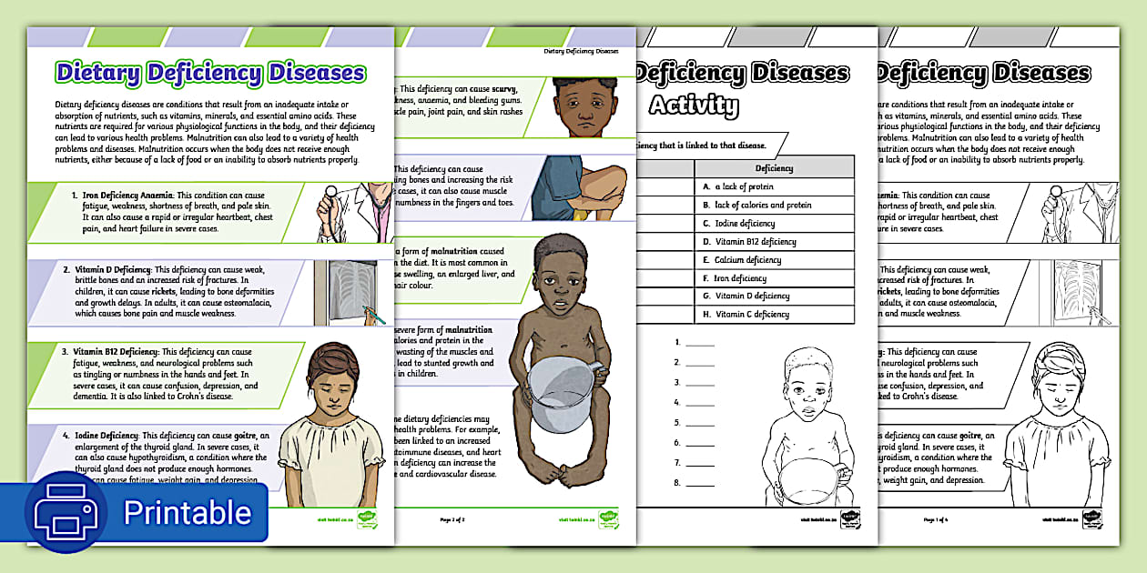 Dietary Deficiency Diseases