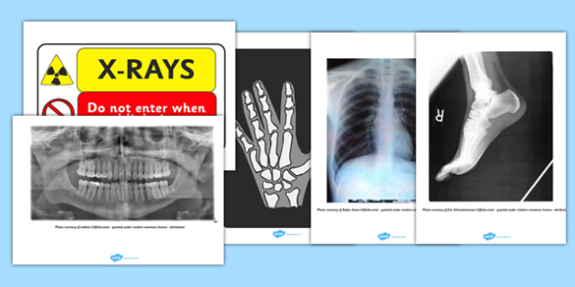 X-Ray Display Signs - Hospital Role Play, hospital resources