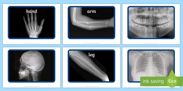Human Body X Ray Photos Display Resources teacher Made Human Body X Ray Photos Display Resources teacher Made