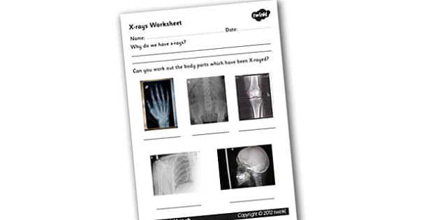 X-ray Worksheet (صُمم من قبل مُختصّين)