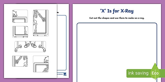 'X' Is for X-Ray Craft (teacher made) - Twinkl