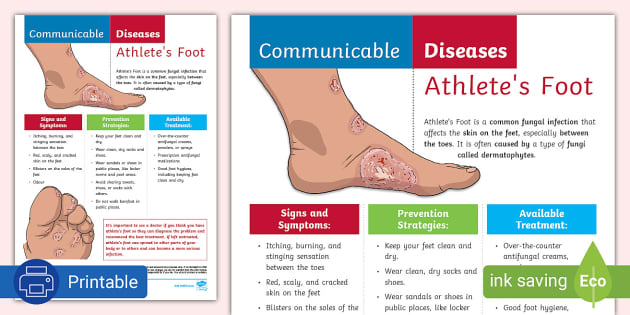 Athlete's Foot: Causes, Symptoms, and Diagnosis